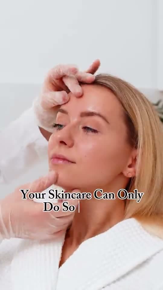 Real microneedling with exosomes treatment at PureSkin, Welbeck Street